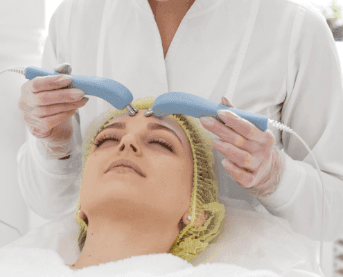 Dermaplaning
